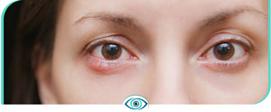 Vision Tests in Nicetown, CA 