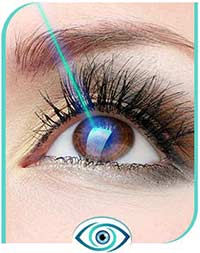 Lasik Eye Surgery Pre and Post Operative Care in Nicetown CA 