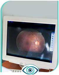 Flashes and Floaters Treatment in Nicetown, CA 