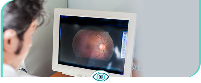Flashes and Floaters Treatment Questions and Answers
